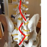 腰椎と仙骨の変位